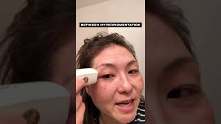 OPTEmist Kara S. | How to Spot Treat for Best Results