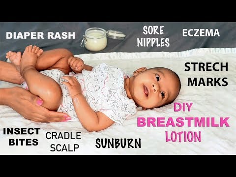 Breast Milk Lotion (Eczema, Diaper Rash, Stretch Marks, Sore Nipples) - NATURAL DIY | ARIBA PERVAIZ