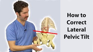 Lateral Pelvic Tilt Correction (4 step guide) - Works FAST!
