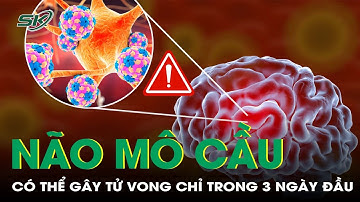 Cảnh báo: viêm màng não mô cầu có thể gây tử vong chỉ trong 3 ngày đầu | SKĐS