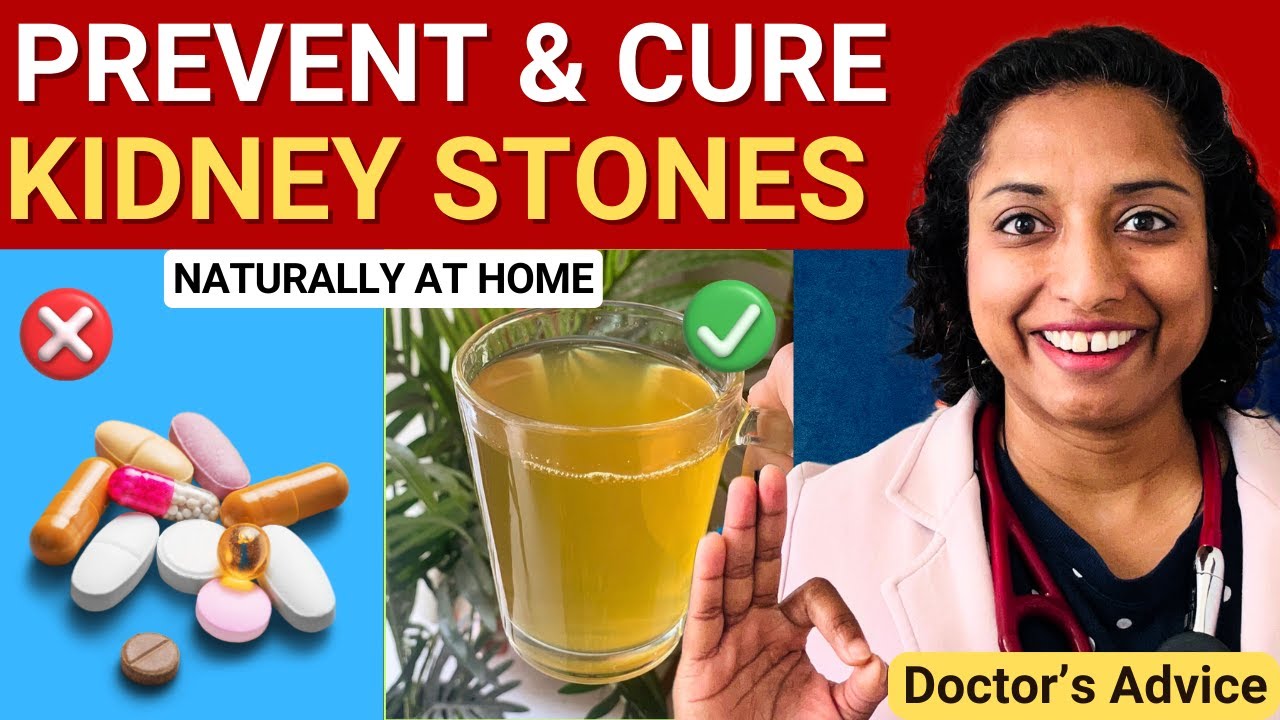 DON'T IGNORE IT...Prevent kidney stone formation Naturally at home | Dr. Neha Garg
