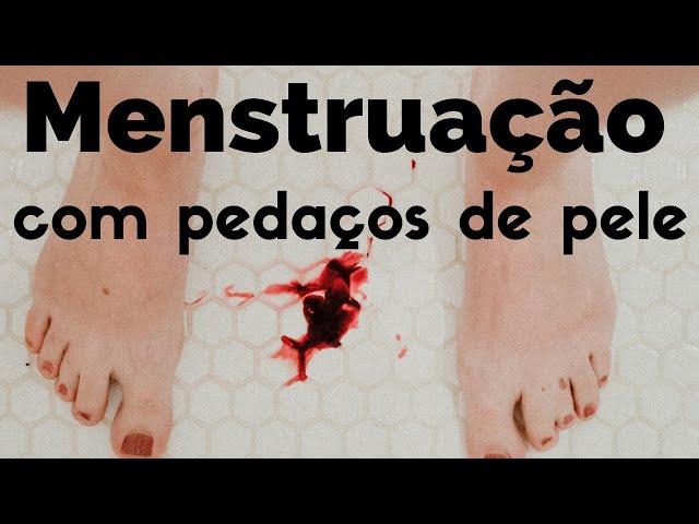 Sete causas da menstruação com pedaços de pele