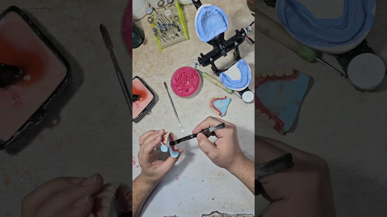 🦷💥ProDentalProsthetics Secret First Step 