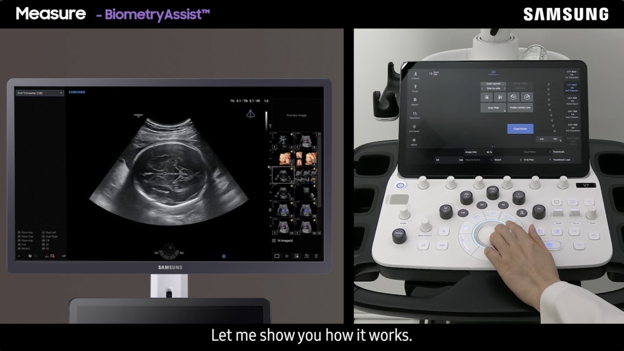 Tutorial V7 Basics Gynäkologie