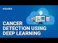 Cancer Detection Using Deep Learning | Deep Learning Projects | Deep Learning Training | Edureka
