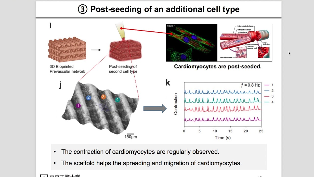 Review: Microfluidic Bioprinting of Heterogeneous 3D Tissue Constructs ...