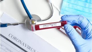 Amazon begins making coronavirus testing lab for workforce