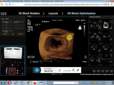 3D ECHO 3 - YouTube