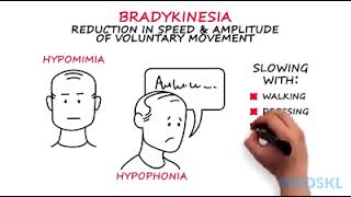 what's is Parkinson's disease! How it affect & Treatment protocol #collected