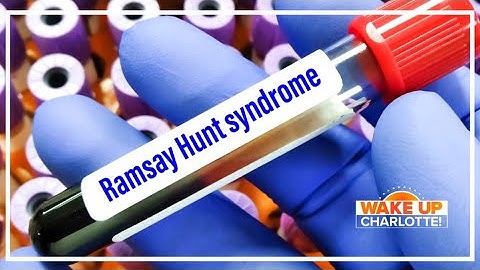 Ramsay Hunt syndrome; your questions answered