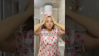 24 Saatlik Acil Nöbetimden Sonra Toplarlanma Rutinim Değil