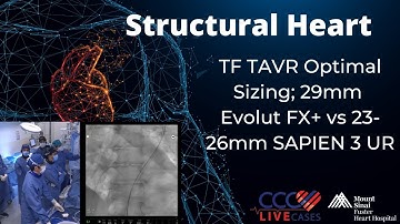 TF TAVR Optimal Sizing; 29mm Evolut FX+vs 23-26mm SAPIEN 3 UR