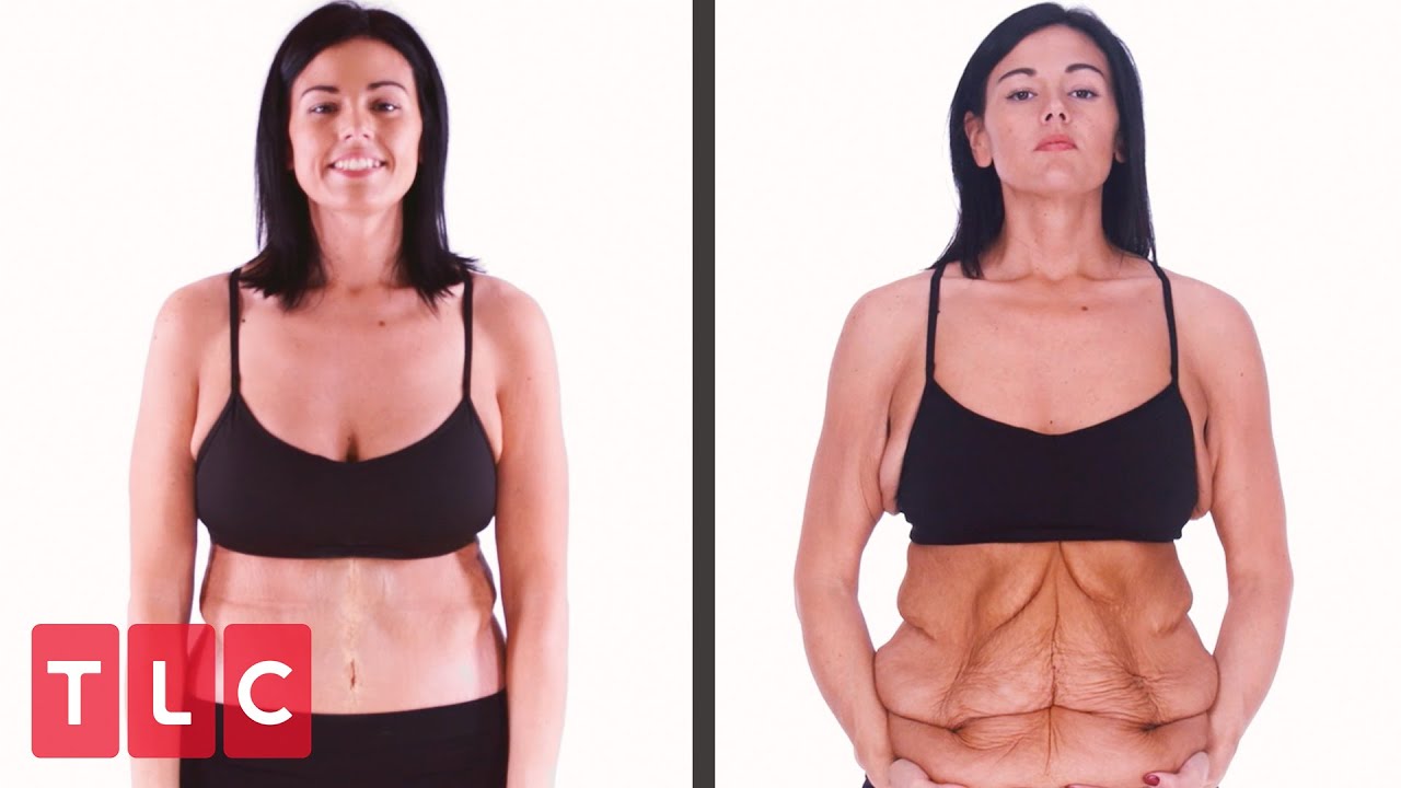 Incredible Skin Removal Transformations