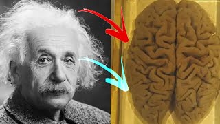 The man who stole Einstein's brain