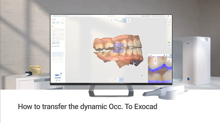 How to transfer the dynamic occlusion to exocad