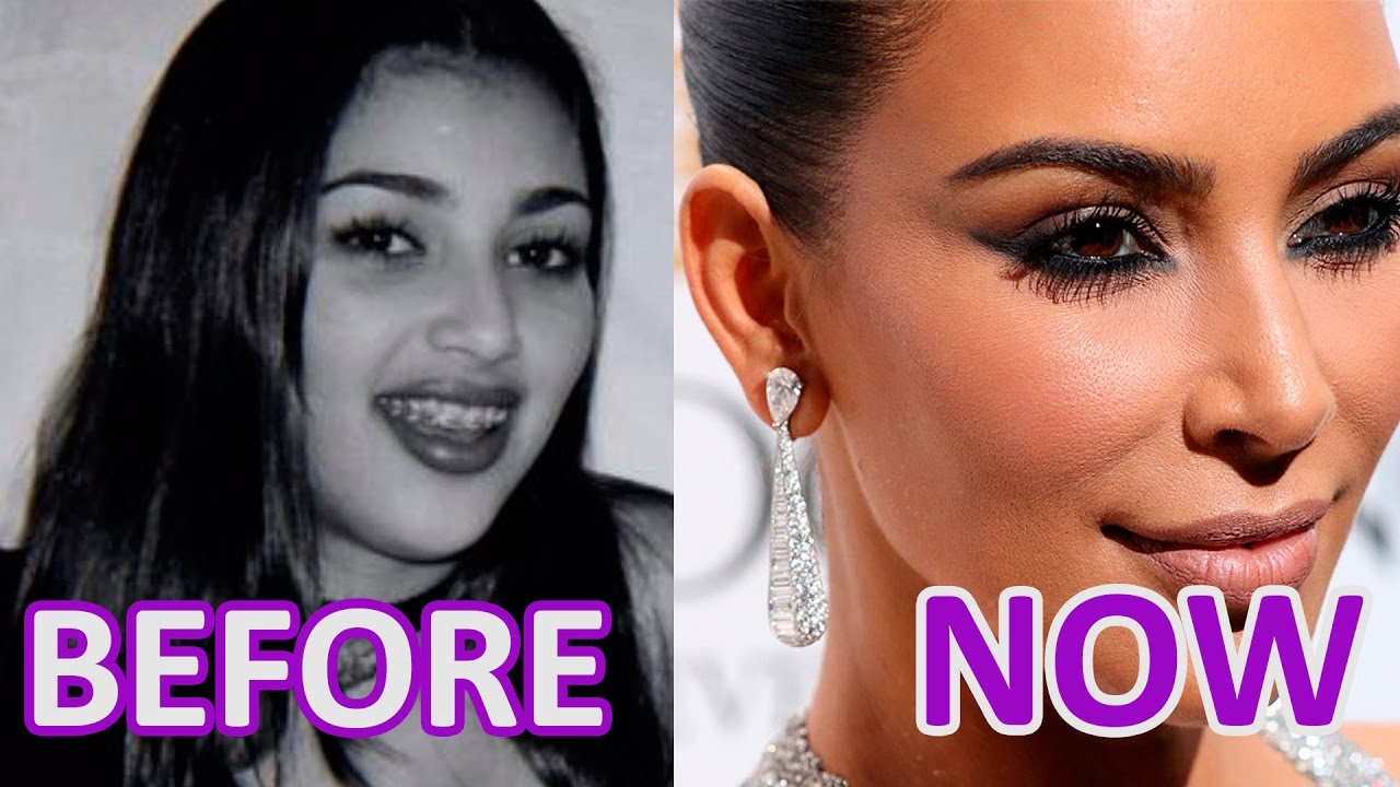KIM Kardashian: BEFORE and NOW. Women and Time  YouTube