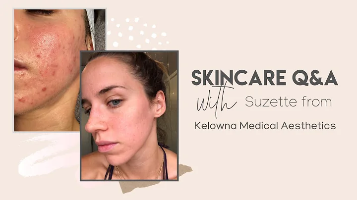 Skin Care Update and Q&A with Kelowna Medical Aesh...