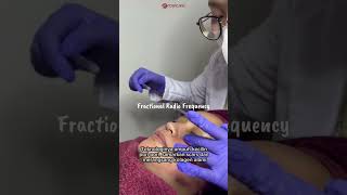 Solusi scars dan pori - pori besar yaa FRF 😉#dokterkecantikan #skincare #rosecare #fypシ 