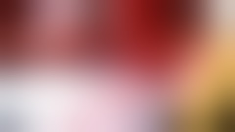 VTI InterFuse S Interbody Fusion Device Insertion Sequence 1