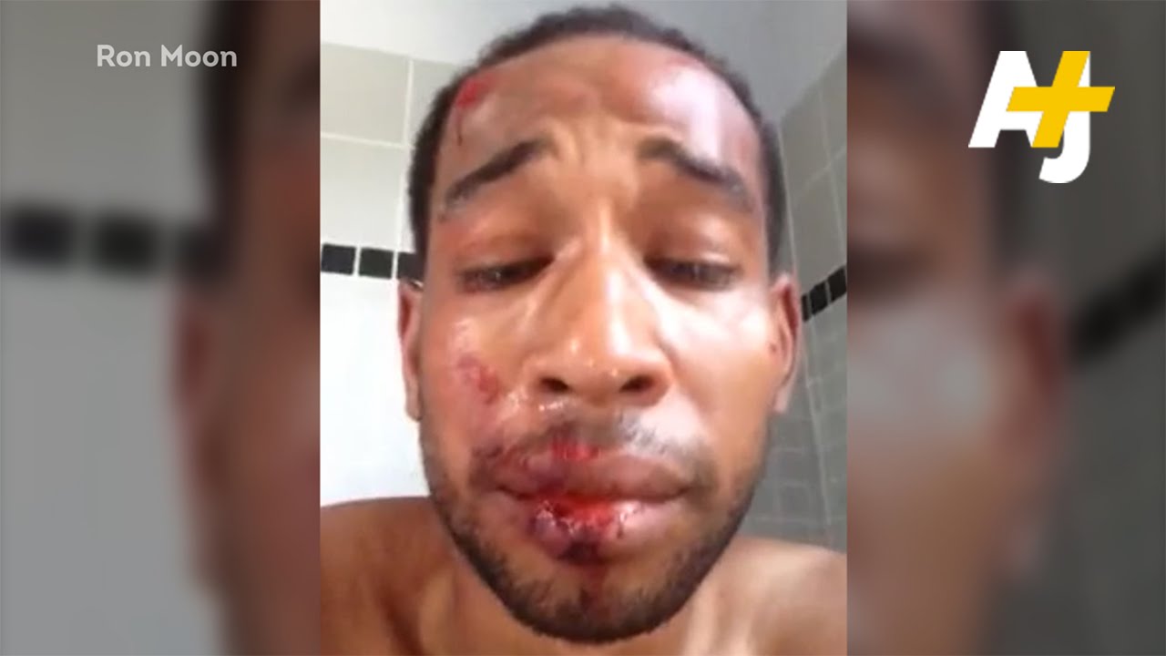رجل يتعرض للضرب لمحاولته تحسين الحي