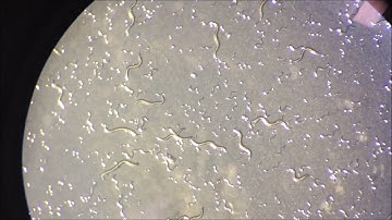 C.  elegans under microscope