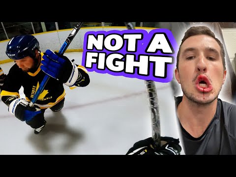 I Cut my Lip in Beer League (and it was entirely my fault)