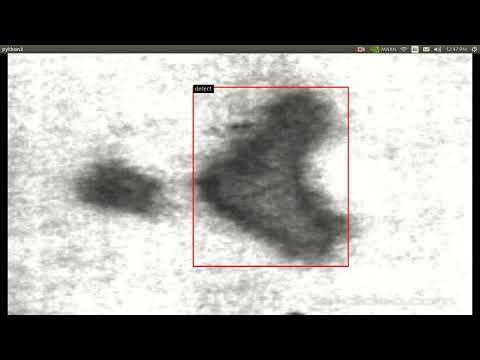 Defect detection on the metal surface