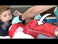 Ollie Gets His Cast Removed!