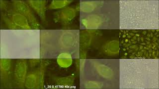 ANA HEp2 Patterns canine serums