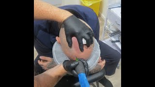 First session for our new client is UNDERWAY! We're mapping his head during his first session.