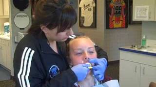 Getting an impression at Kaufman Orthodontics