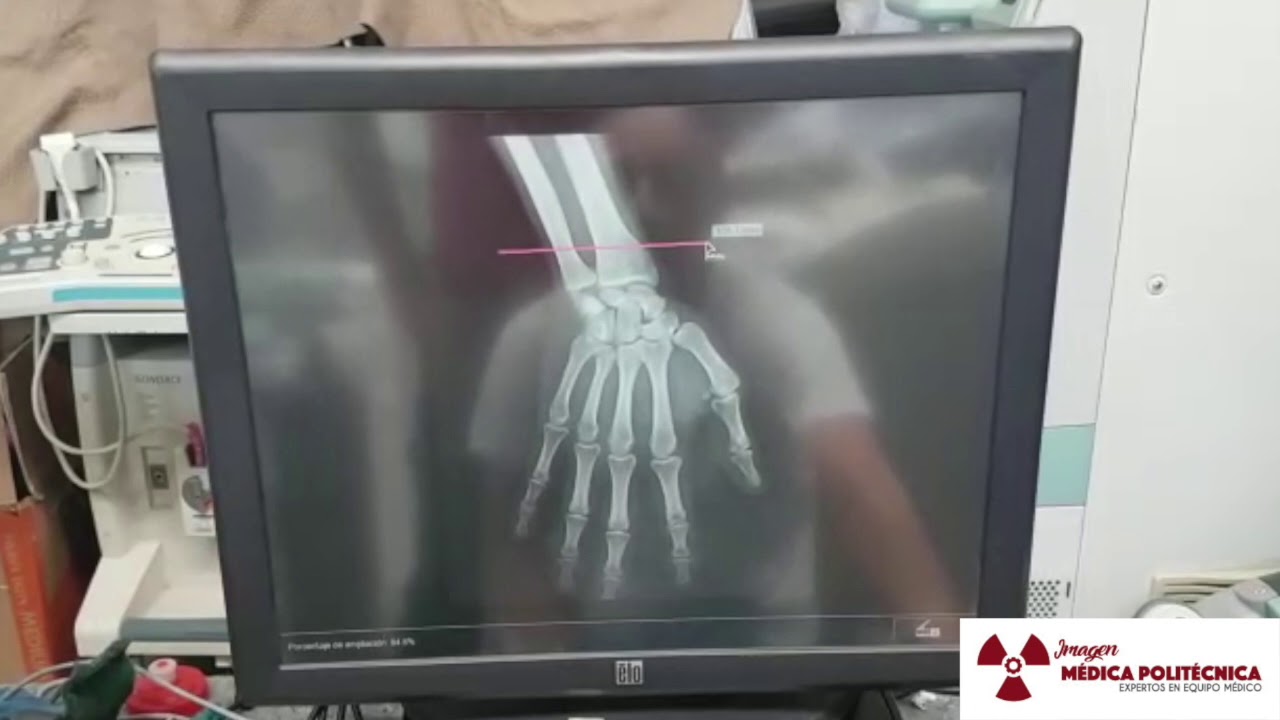 Maquillado de imágenes con digitalizador Fujifilm.