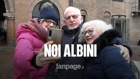 Il mondo degli albini raccontato da chi lo vive: "Quando andavo a scuola mia madre si vergognava"