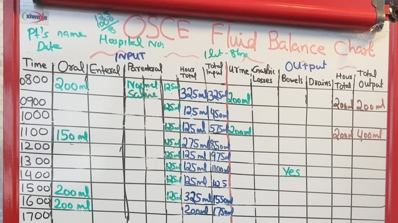 Fluid Balance Chart In OSCE Exam For Nurses In The Uk OSCE Silent Skill Fluid Balance Chart In OSCE Exam For Nurses In The Uk OSCE Silent Skill