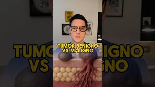 Benign vs. malignant tumor: The difference that changes everything #medicine #healthtips #shorts