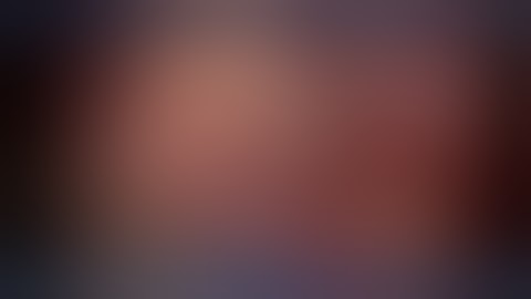 "Abnormal Biliary Anatomy- A Cautionary Example"- Mr Gerry McEntee, MMUH