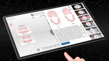 Video №24. Types of implant placement on a toothless jaw