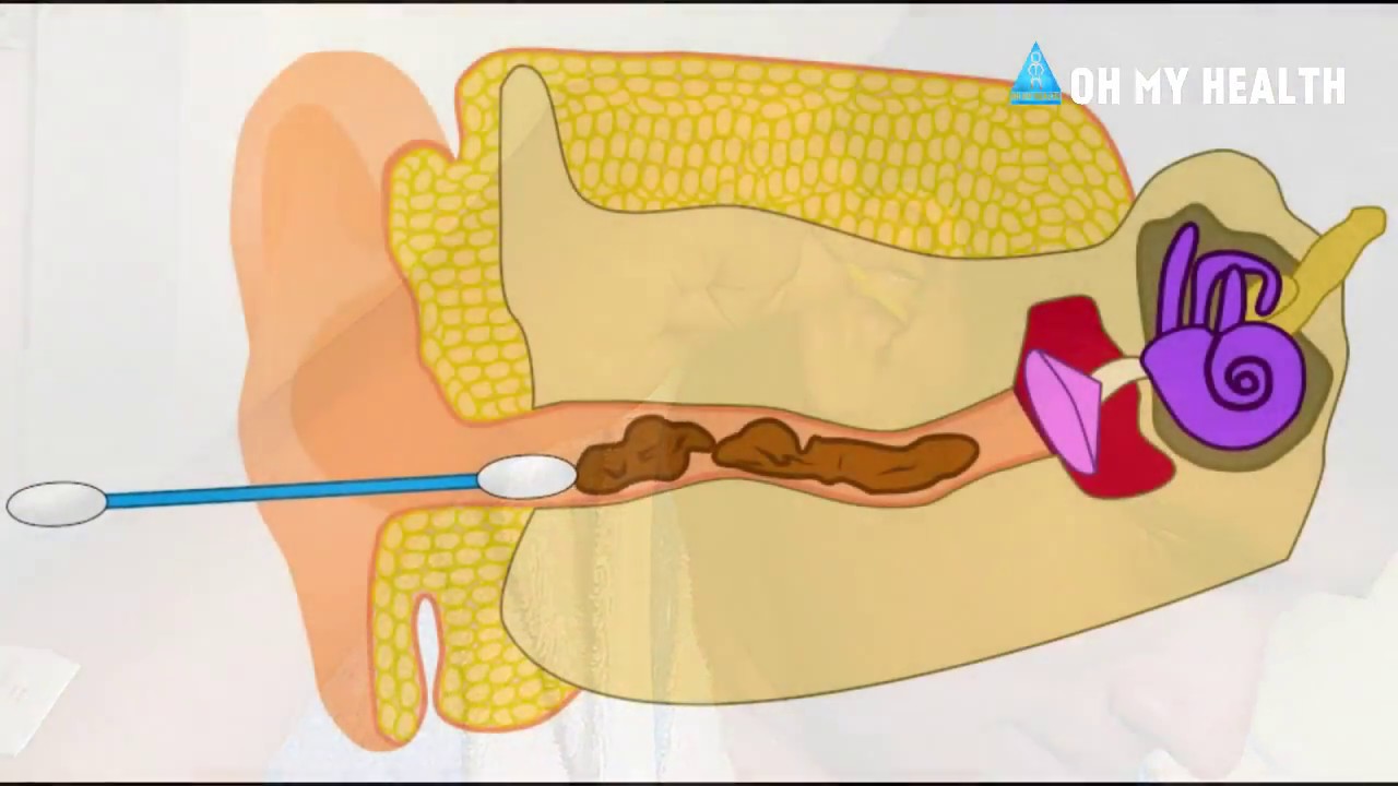 Don't use Earbuds ; cotton swab is bad for ears YouTube