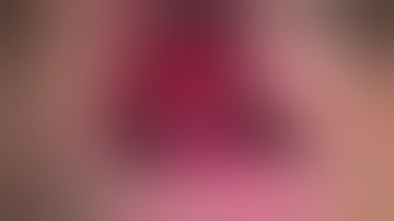 EPI Guide Membrane, Flap Design & Suturing. How to place membrane for dentistry