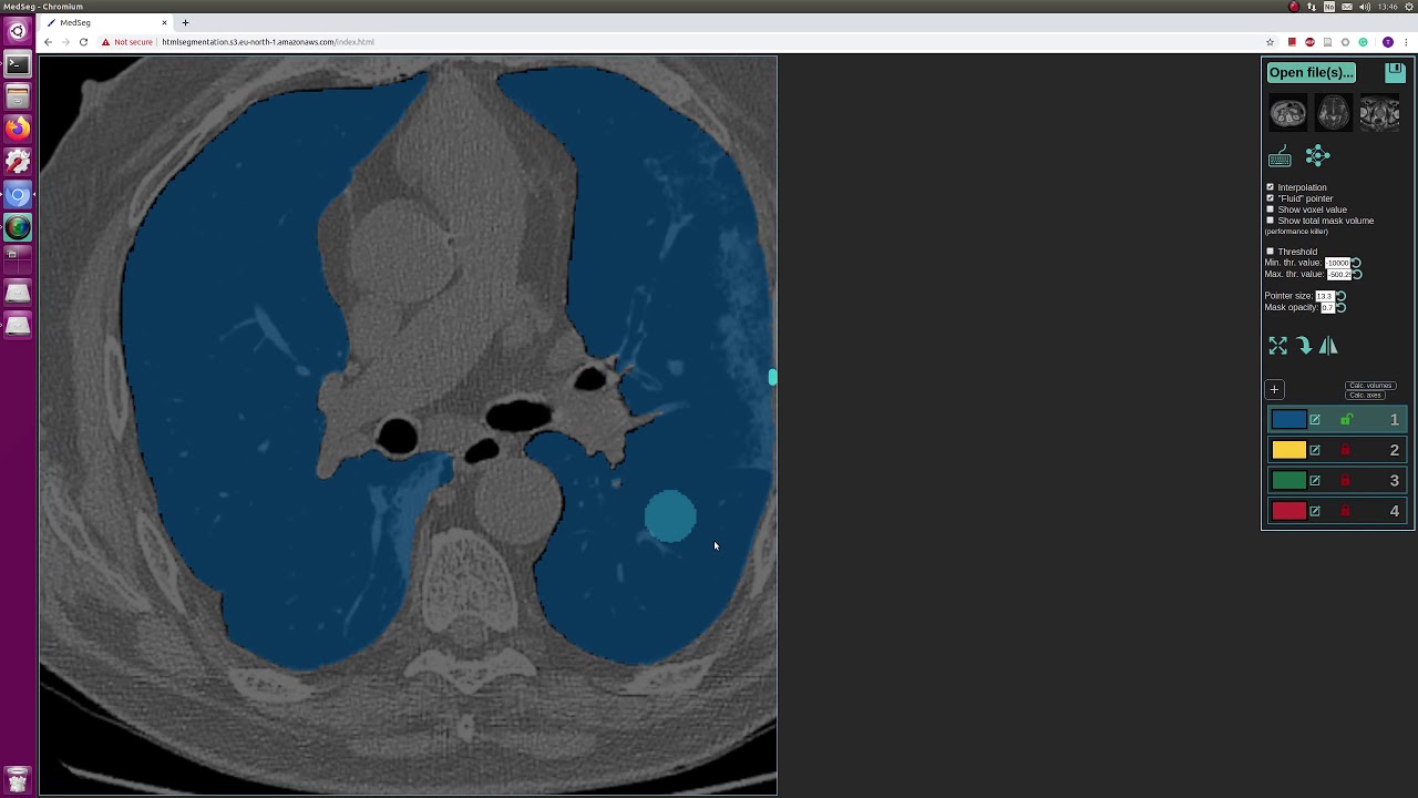Segmentation of lungs on CT start to finish in the web-browser.
