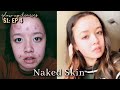 Glow up Diaries (Episode 4) acne to clear skin (my journey) + nike headquarters