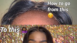 BEGINNER FRIENDLY; HOW TO FIX YOUR LIFTING LACE CLOSURE 