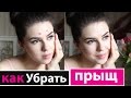 Как УБРАТЬ ПРЫЩ? #missAnnsh