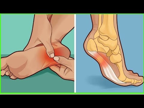 7 Natural Sprained Ankle Treatments to Get You Back on Your Feet Again