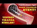 Stent, Damar Tıkanıklığı, Riskler, Prof.Dr.Serdar Akgün, Serdar Akgün Videoları