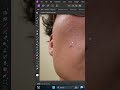 Erase Pimples in 3 Seconds #affinityphototutorial #affinityphoto #pimple