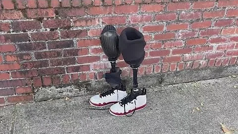 Prosthetic legs found near Vancouver convenience store