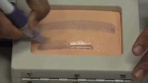 Sticky Situation: How Mesh and Glue Replace Sutures