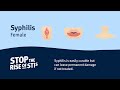 Sexual Health - Syphilis (Female)