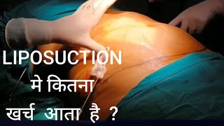 Liposuction cost hyderabad nalgonda nizamabad warangal mumbai pune ahmedabad Chandigarh baroda